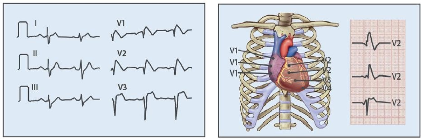 chiarelli cardiologo pinerolo torino