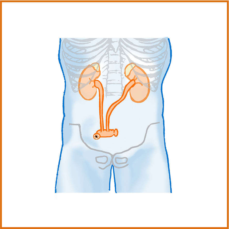 urostomia pinerolo punto san lazzaro
